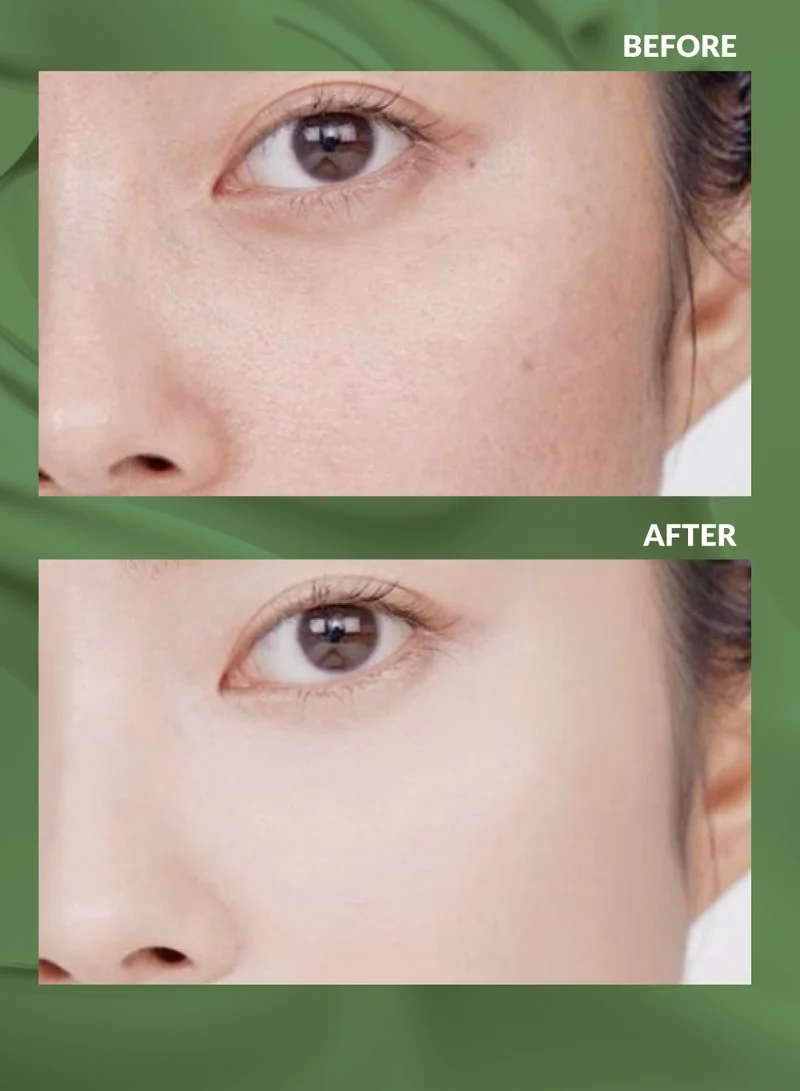Terrazen PDRN Total Renew 10 Pcs Korean Face Sheet Mask with Retinol 25 ml - Natural Beauty Skincare For All Skin Types - Firming Mask for Women & Men