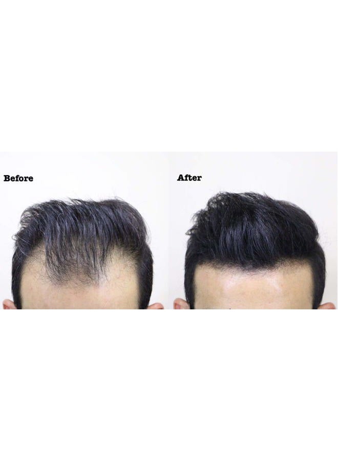 Thick Fiber ألياف شعر سميكة لتخفيف الشعر والبقع الصلعاء (أسود، عبوة من 3) - زجاجة 25 جرام - تخفي تساقط الشعر في ثوانٍ - مسحوق شعر للنساء والرجال - Image 3