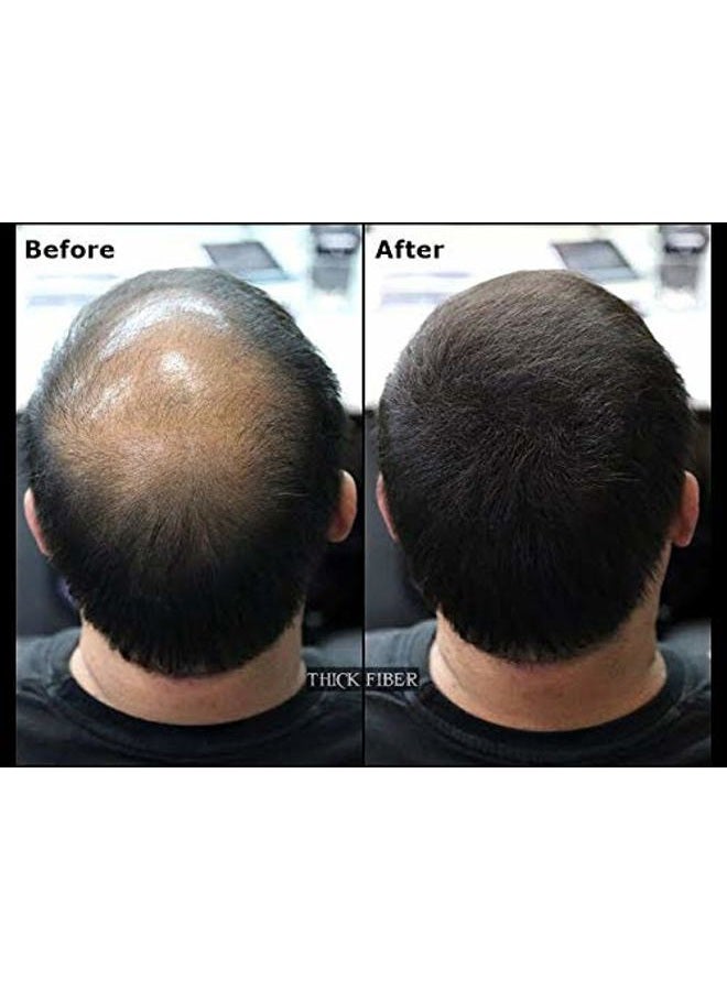 Thick Fiber ألياف شعر سميكة لتخفيف الشعر والبقع الصلعاء (أسود، عبوة من 3) - زجاجة 25 جرام - تخفي تساقط الشعر في ثوانٍ - مسحوق شعر للنساء والرجال - Image 4