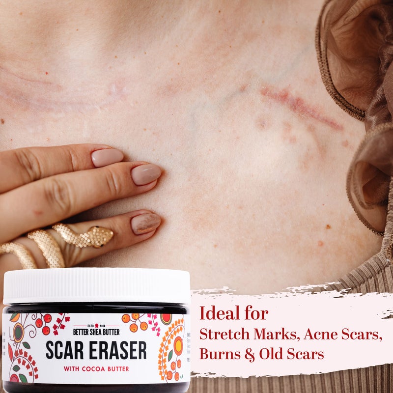 Better Shea Butter Scar Eraser Balm - Cocoa Butter Cream for Stretch Marks and Dark Spots, Burns, Old Scars - Acne Scars - Designed w Zero Synthetic Ingredients, 4 oz - Image 4