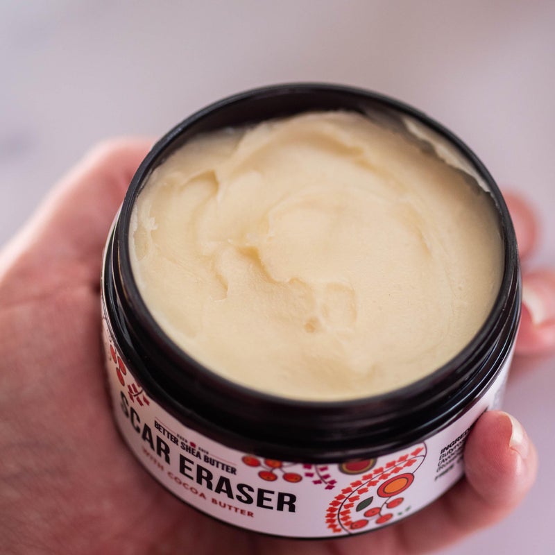 Better Shea Butter Scar Eraser Balm - Cocoa Butter Cream for Stretch Marks and Dark Spots, Burns, Old Scars - Acne Scars - Designed w Zero Synthetic Ingredients, 4 oz - Image 2