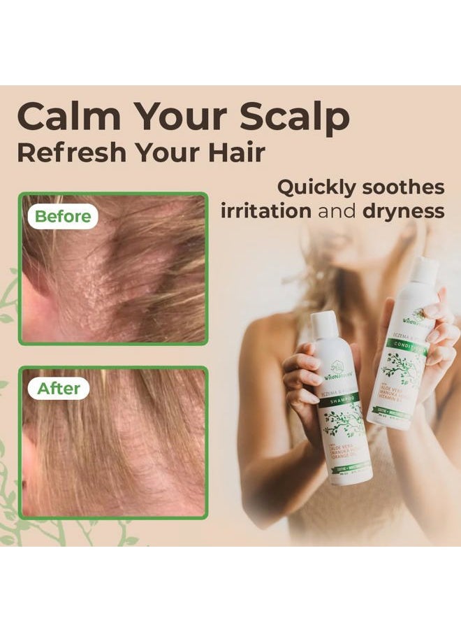 Wild Naturals - Anti-Dandruff & Seborrheic Dermatitis Treatment Shampoo & Conditioner Set for Men & Women - For Itchy, Dry Scalp and Hair with Psoriasis & Eczema - Image 1