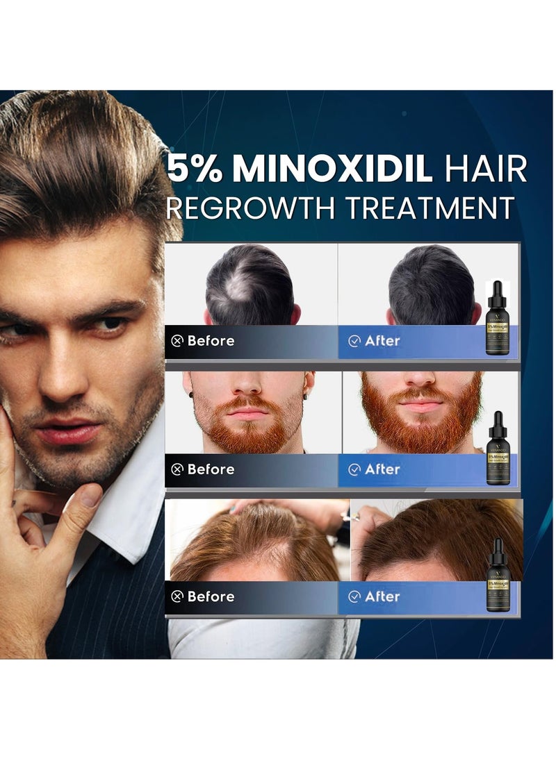 Venanoci - 5% Minoxidil Hair Growth for Men and Women: Biotin Hair Growth Serum for Hair Loss, Thinning, and Faster Regrowth Treatment - 60ML - Image 1