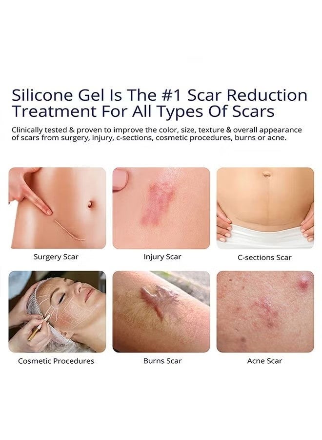 ASMOXA Silicone Scar Gel 30g, Medical Grade Silicone Scar Cream, Advanced Scar Removal Gel for Surgical Scars, Stretch Marks, Acne, Injury Burns - Image 3