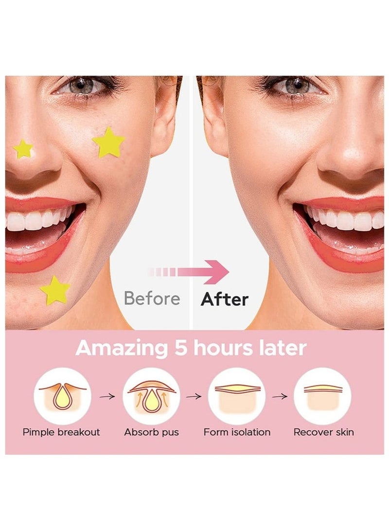 اكني باتش رقعة لعلاج البثور، 600 قطعة، ملصقات لتغطية حب الشباب للوجه والبشرة، للعناية اليومية بالبشرة للرجال والنساء - Image 2