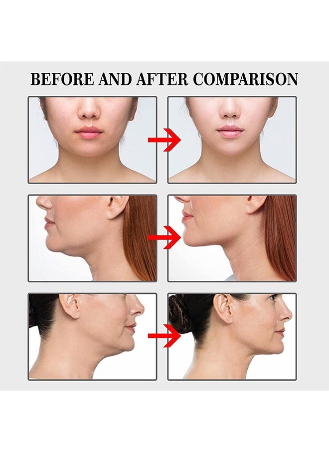 Beyond - 40 Pcs Face Myofascial Lifting Patch, High Elasticity Facial Lift Tape, Skin Lift Tape for Tightening Neck Wrinkles and Saggy Skin - Image 1