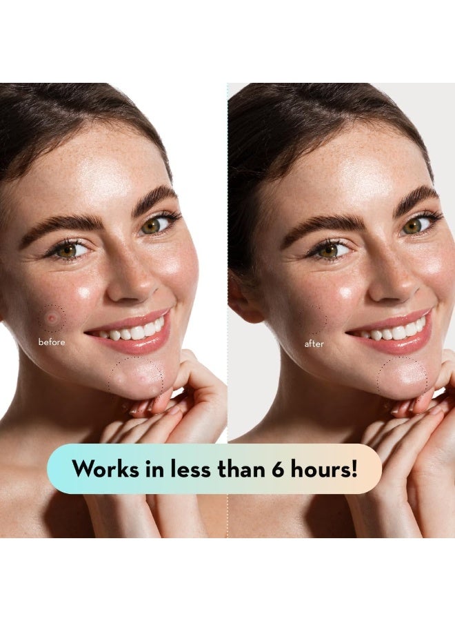 LE GUSHE K-BEAUTY Pimple Patches for Face (132 dots) - Hydrocolloid Acne Patch for Zits and Blemishes - Invisible Blemish Patches | Spot Cover Stickers for Glowing Skin | Korean Skin Care - Image 4