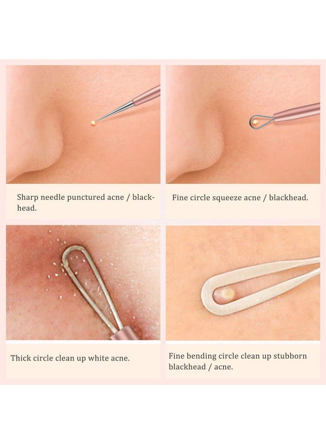 DOCOSS 5 In 1 Stainless Steel Blackhead, Acne & Pimple Removal Acne Needle Tool Set With Metal Case Rose Gold - Image 3