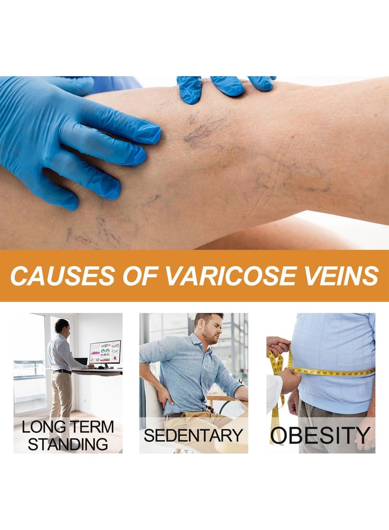 ساوث مون مجموعة علاج دوالي الساقين: رذاذ لتحسين الدورة الدموية بسعة 30 مل، 12 قطعة من معجون تخفيف دوالي العروق، وكريم للساقين بوزن 30 غ لتقليل التورم والألم. - Image 3