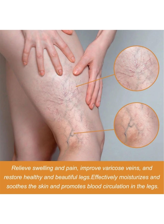 ساوث مون مجموعة علاج دوالي الساقين: رذاذ لتحسين الدورة الدموية بسعة 30 مل، 12 قطعة من معجون تخفيف دوالي العروق، وكريم للساقين بوزن 30 غ لتقليل التورم والألم. - Image 4