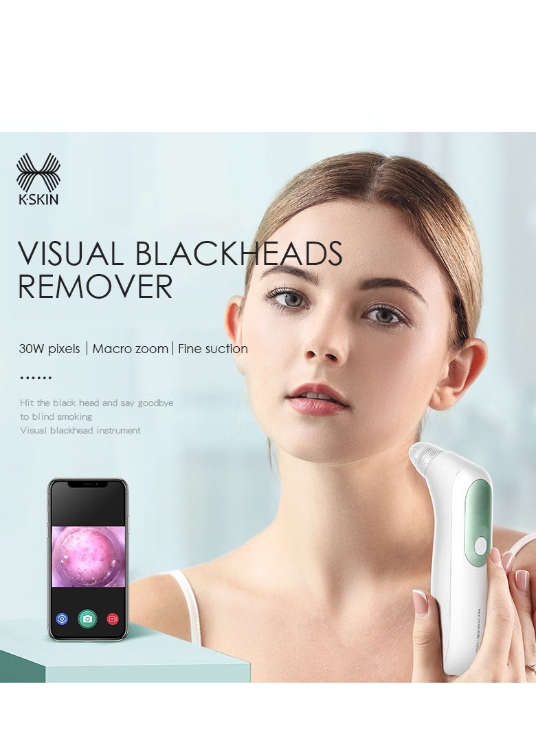 Blackhead Remover with Camera,Pore Vacuum with HD Camera for Skin Care,WiFi Facial Acne Extractor with 3 Adjustable Suction Power White