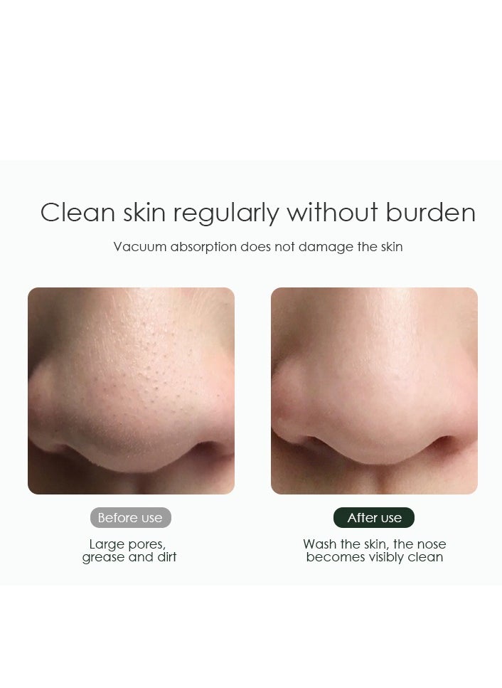 Blackhead Remover with Camera,Pore Vacuum with HD Camera for Skin Care,WiFi Facial Acne Extractor with 3 Adjustable Suction Power White