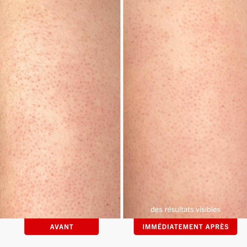 First Aid Beauty مقشر الجسم من First Aid Beauty KP Bump Eraser لعلاج حكة الجلد الجافة مع 10% من حمض ألفا هيدروكسي - 8 أونصة - Image 3