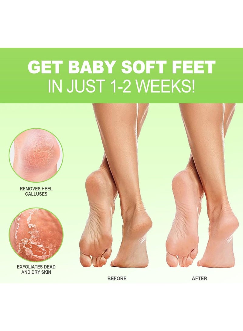 JVR JVR Foot Peel Mask - 3 Pairs - Exfoliating Peeling Callus Remover, Repairs Cracked Heels & Dry Skin, for Smoother and Softer Feet (Aloe Vera)  - Image 3