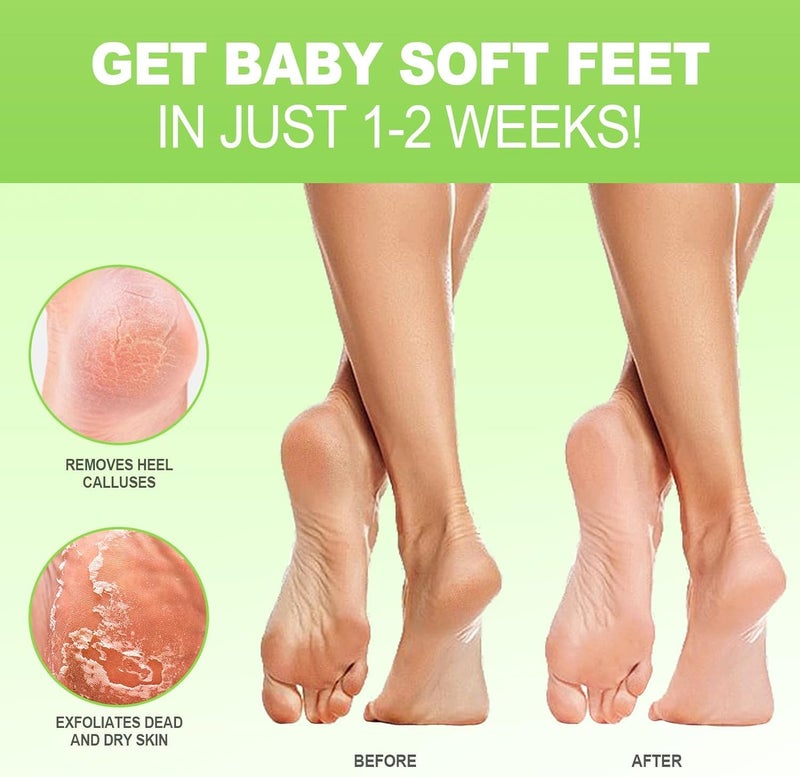 JVR Foot Peel Mask - 3 Pairs - Exfoliating Peeling Callus Remover, Repairs Cracked Heels & Dry Skin, for Smoother and Softer Feet (Aloe Vera) - Image 2