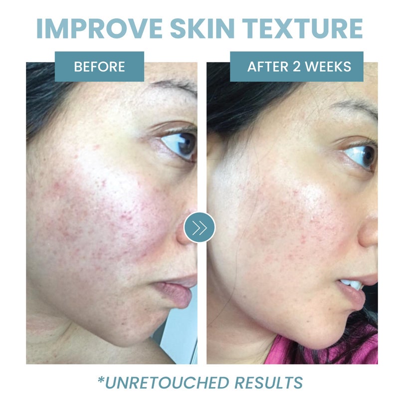 Eva Naturals سيروم ببتيد الكولاجين - سيروم مضاد للشيخوخة للكولاجين للوجه، تفتيح البشرة، يقلل من الخطوط الدقيقة والتجاعيد، يشفي ويصلح البشرة، سيروم ميكرونيدلنج مع حمض الهيالورونيك (2 أونصة) - Image 5