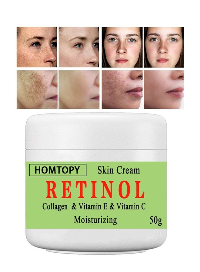 HOMTOPY Retinol &Collagen & Vitamin E &Vitamin C  Moisturizing Skin Cream, Dark Spot Remover For Face For Face Snd Body Hyperpigmentation, Fades Melasma, Freckle, Sun Spots, Evens Skin Tone, Age Spot Remover 50g - Image 1