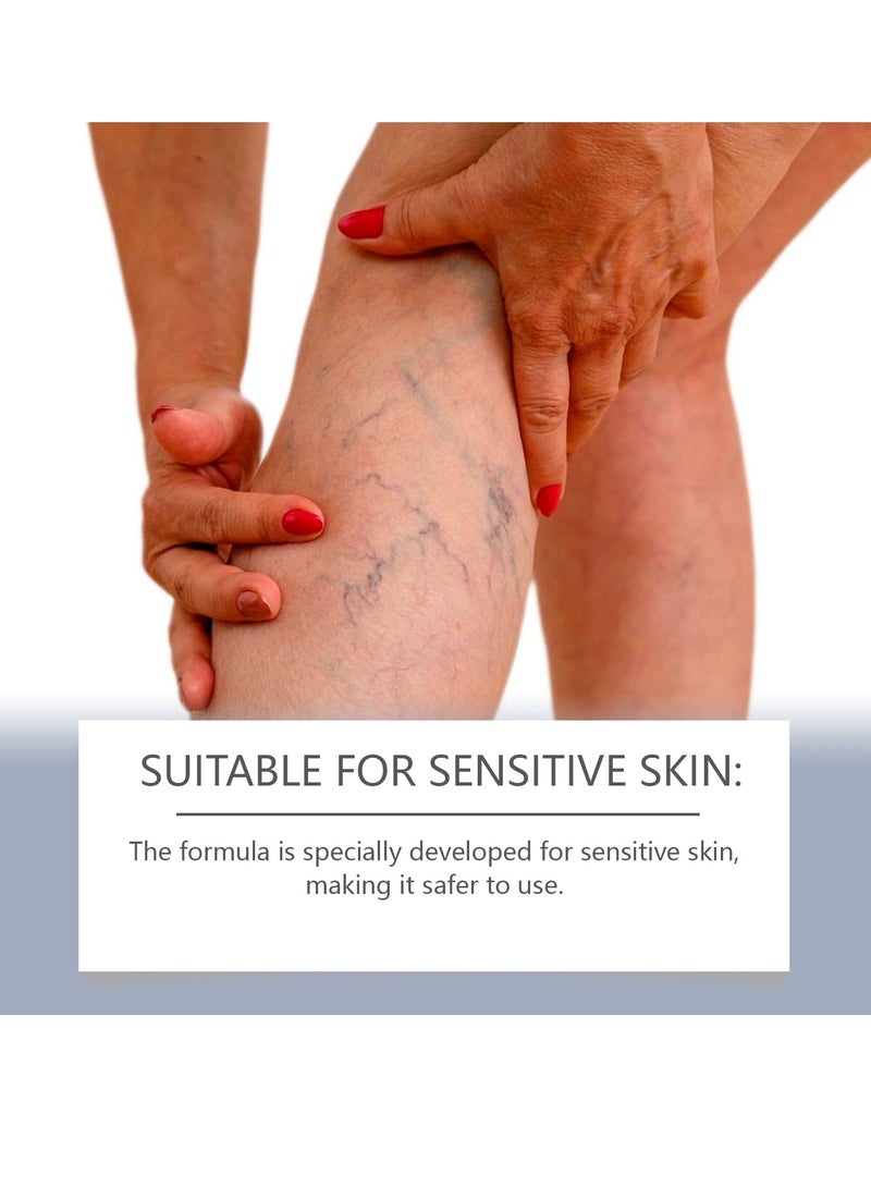 SOUTH MOON Cream Ayurvedic Solution For Management Of Varicose Veins, Spider Veins, Varicocele Helps reach the root cause of varicose veins Reduces Cramps, Itching & Swelling. Single Tube (20 gms).  - Image 3