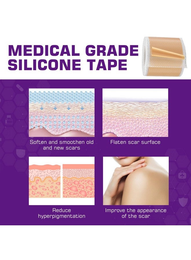 Kelinul Silicone Scar Sheets(1.6 X 120"Roll) Scar Removal Silicone Scar Tape For Softening And Flattening Scars, Acne, C-Section, Keloid Surgery, Painless Removal, Reusable, Washable, 12 Month Supply - Image 3