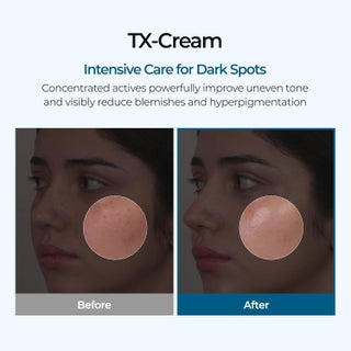 Dr. Melaxin TX Tranexamic Acid Cream - view 2
