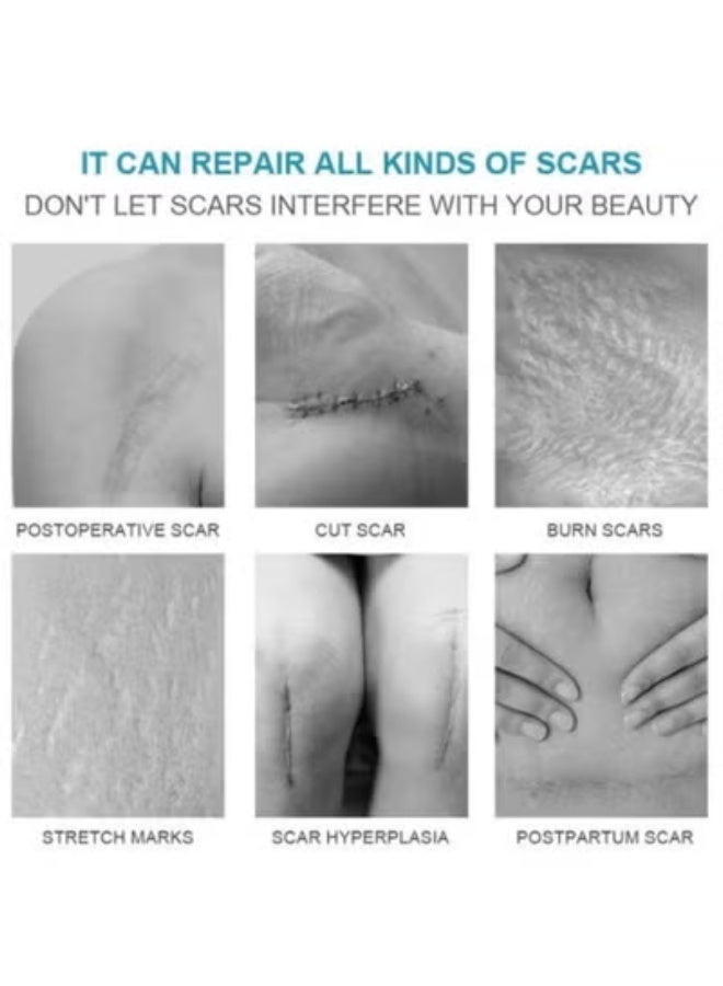 LANEMAY Scar Disappears, Medical Grade Silicone Scar Cream Advanced Scar Removal Gel For Surgical Scars Stretch Marks Acne Injury Burns Keloids Hypertrophic Old And New Scars 20G - Image 2