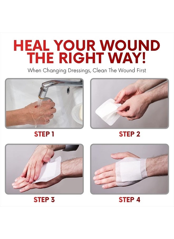 HEALQU - HEALQU Bordered Gauze Island Dressing - 30 Count, 4" x 4" Sterile Individually Wrapped Gauze Pads with Water-Resistant, Non-Woven Backing - Soft and Breathable Wound Dressing for First Aid and Medical - Image 1