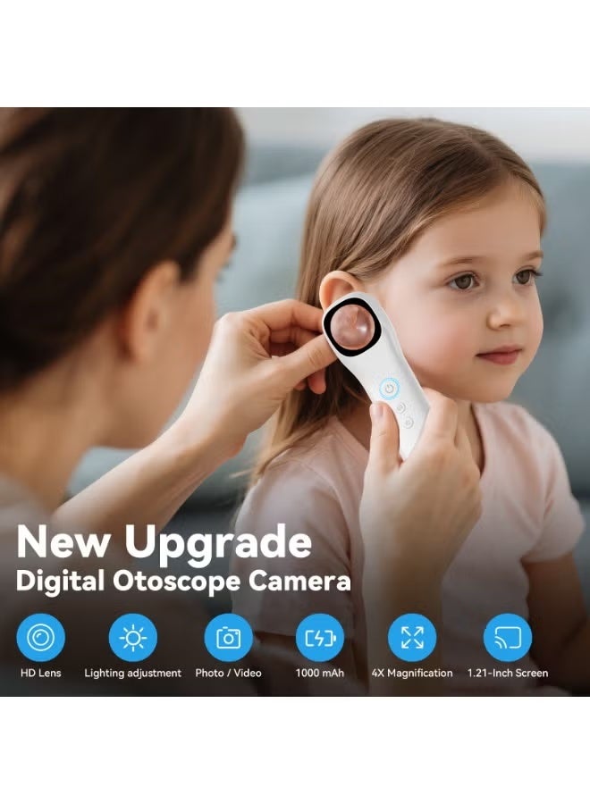 High-definition display otoscope camera, 1080P pocket-sized otoscope, 1.21-inch IPS color screen wireless otoscope with 4 LED lights, portable inspection camera kit, suitable for adults, children, and pets (white) with 128GB Memory Card - Image 2