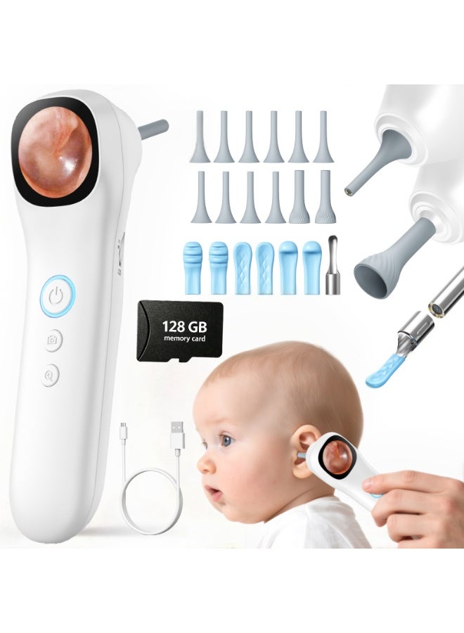 High-definition display otoscope camera, 1080P pocket-sized otoscope, 1.21-inch IPS color screen wireless otoscope with 4 LED lights, portable inspection camera kit, suitable for adults, children, and pets (white) with 128GB Memory Card - Image 1