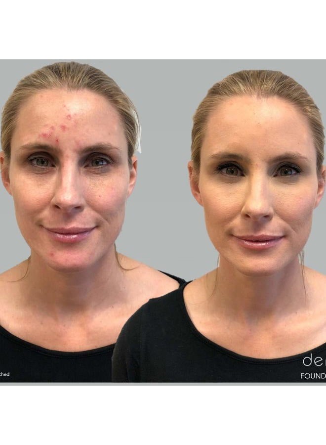 dermaflage لوحة خافي العيوب بتغطية كاملة، كريم خافي العيوب المقاوم للماء، 3 ألوان + فرشاة، من ديرمافلاج - Image 3