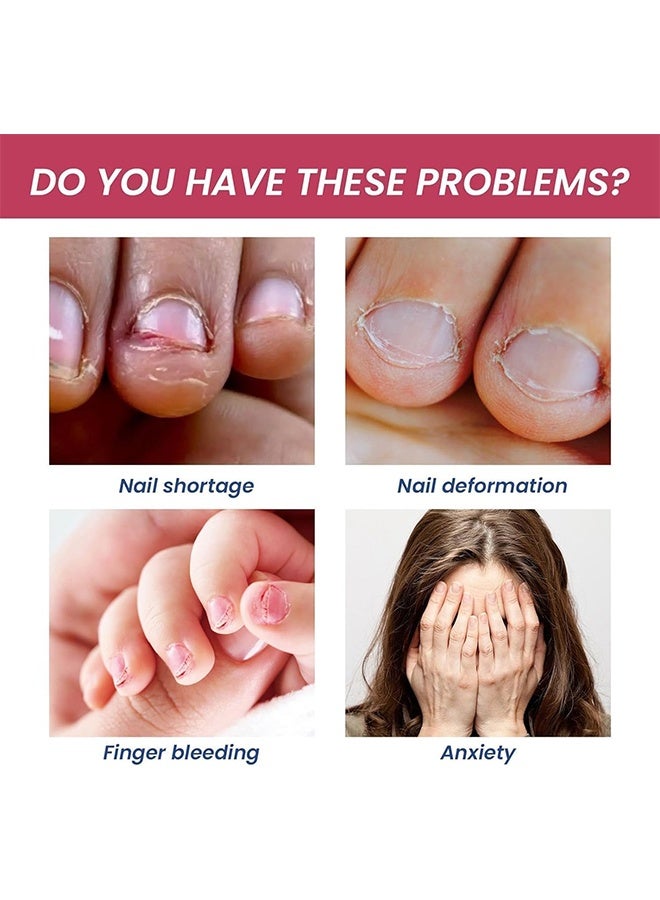 لانثوم Stop Nail Biting, Anti Nail Biting Polish, Clear Varnish to Discourage Nail Biting and Thumb Sucking for Kids and Adults, Plant Extracts (15ml) - Image 5