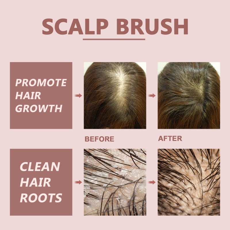 FERNIDA Detangling Brush for Women Girls - Detangler Hair Brush for Straight Long Wet Dry Hair, 572 Soft Bristles Scalp Brush, Purple - Image 5