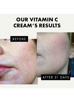 Vitamin C Face Cream - Vitamin C Cream With 2.5% Hyaluronic Acid + 2% Squalane, Vitamin C Moisturizer For Face, Brightening Cream To Reduce Uneven Skin Tone And Wrinkles, Antioxidant Firming Cream - pzsku/ZE23CE17BBF16E4FE608EZ/45/_/1734183359/a79848e7-6c3a-4505-ad74-e92a48d0633a