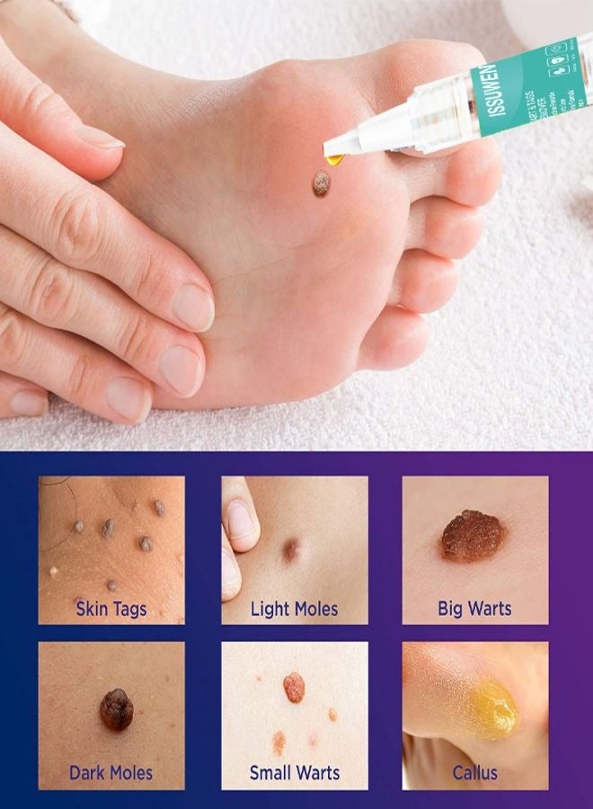 ISSUWEN Portable descaling cream, containing natural extracts, with a mild texture, safe and easy to use. - Image 3