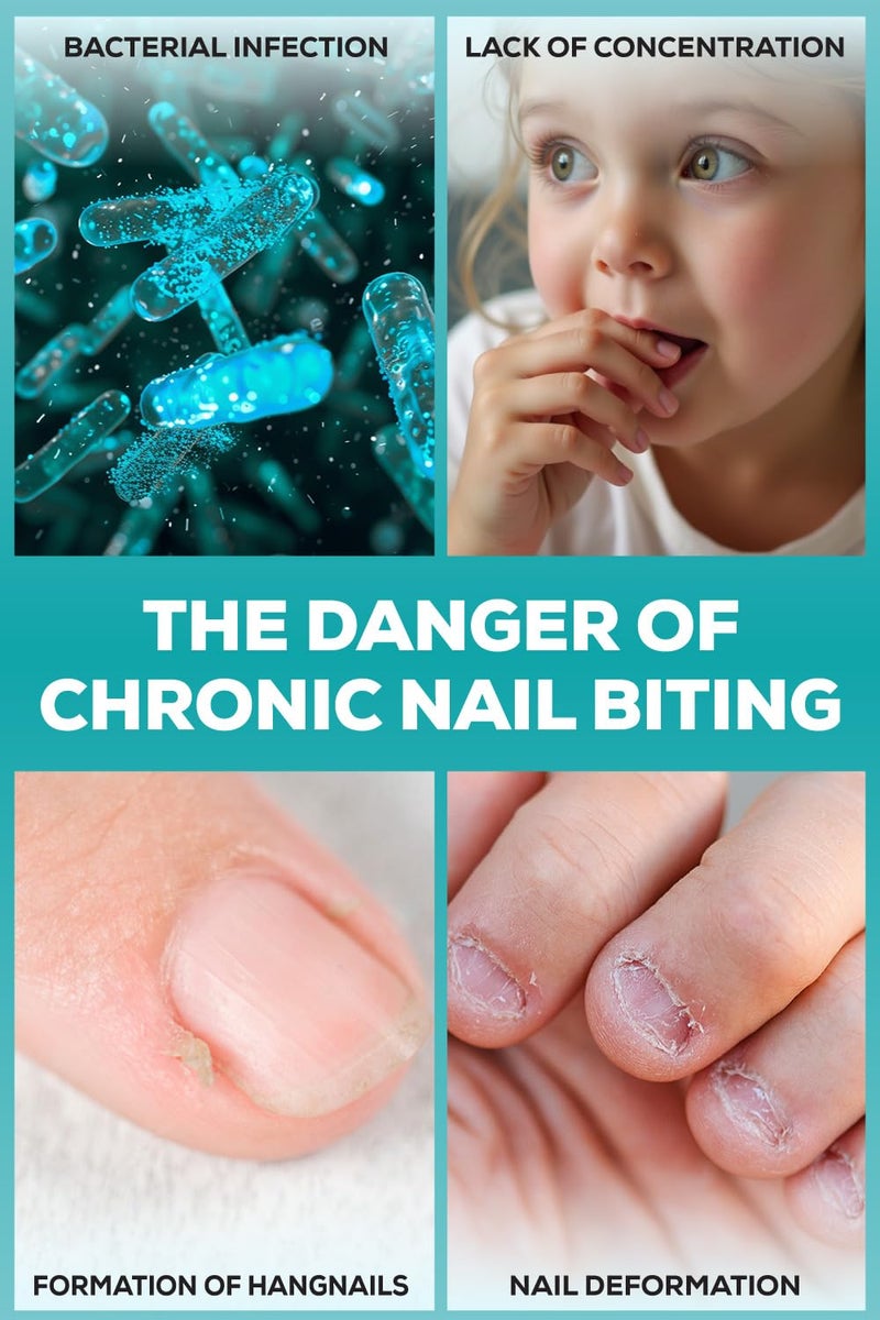 NIXXIT Nail Biting Prevention for Kids - Thumb Sucking Deterrent for Kids, Toddlers, Children - No Bite Nail Polish Pen - Bitter Taste - Safe & Effective Solution for Age 3+ - Image 4