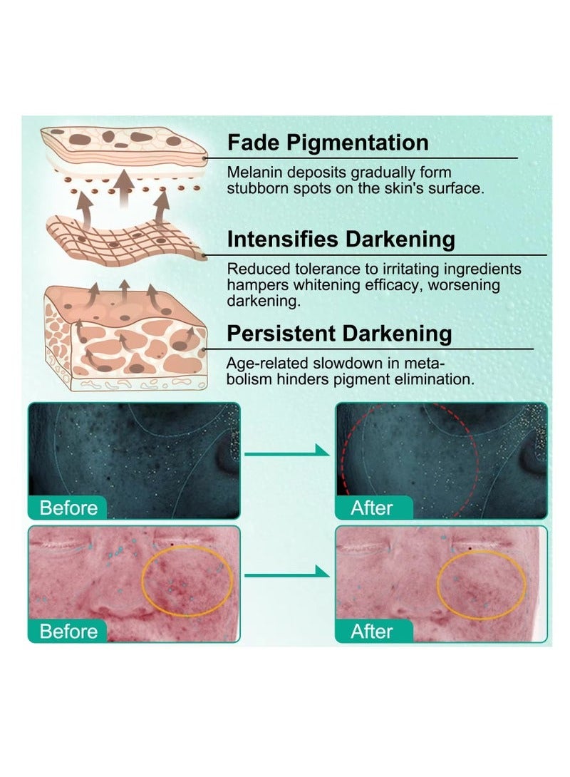 Ikzee whitening moisturizing skin care cream to remove blackheads and brighten skin tone moisturizing cream 50g - Image 4