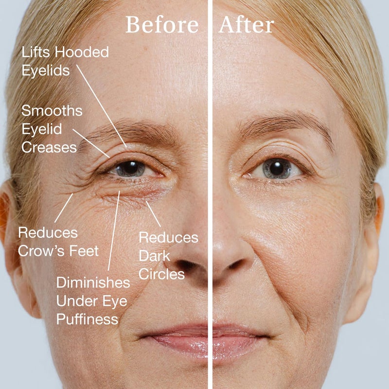 SBLA Eye Lift Wand â€“ Anti-Aging Serum for Eyelids, & Eye Area - With SBLA66Peptideâ„¢, Caffeine, Hyaluronic Acid, Niacinamide & Vitamin C - Smooths, Lifts Hooded Lids, Brightens Eyes, Reduces Puffiness - Image 3