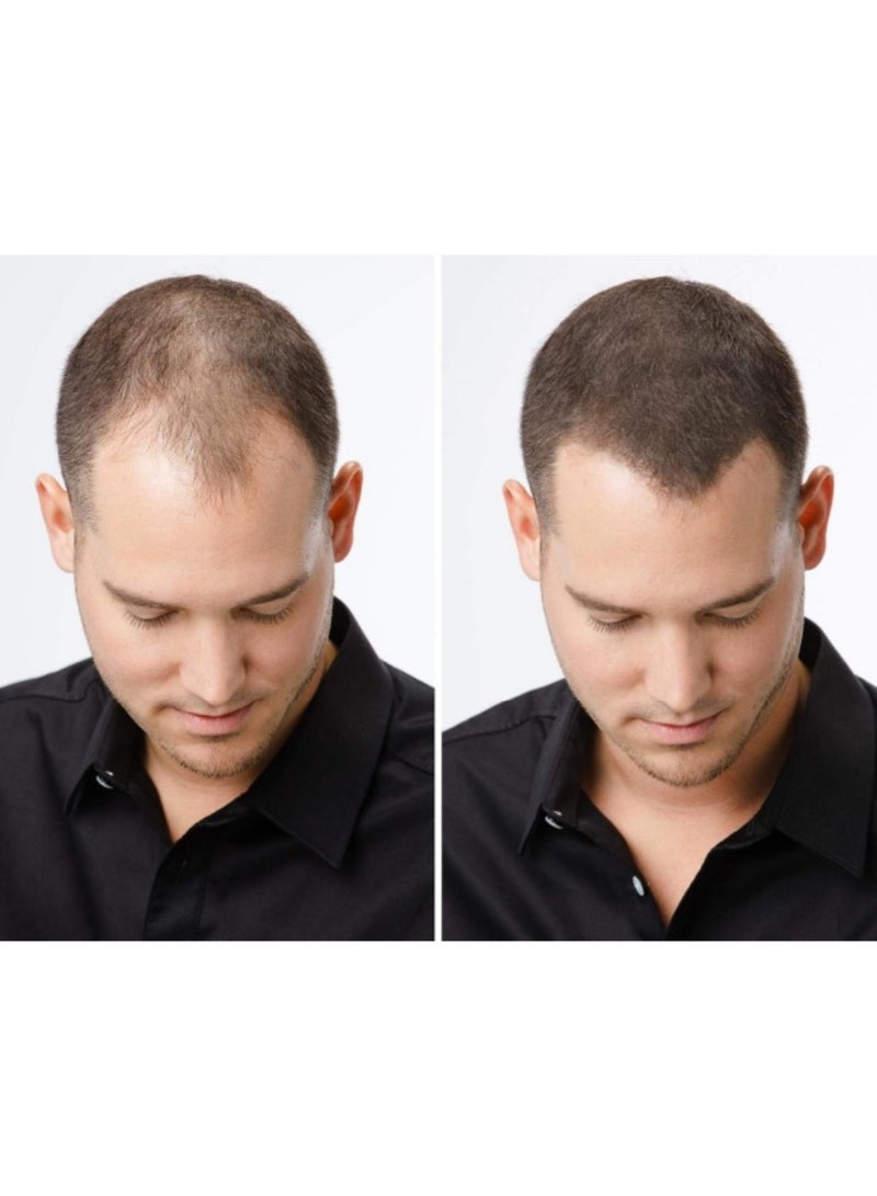 توبيك "ألياف بناء الشعر توبيك - عبوتان باللون الأسود | كيراتين طبيعي لاستعادة الشعر | يثخن الشعر فورًا ويغطي الجذور | سهل التنظيف باستخدام الشامبو" - Image 3