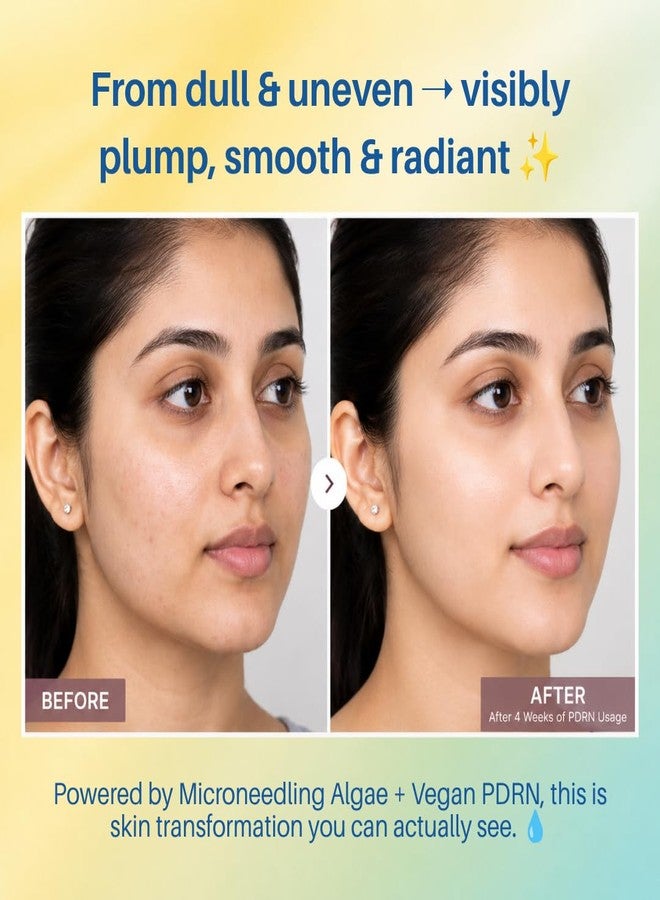 آيجت معزز البشرة المتقدم Aegte Hylu-Collagen مع الطحالب بتقنية الوخز بالإبر الدقيقة ومكونات نباتية PDRN 10 مل - Image 2