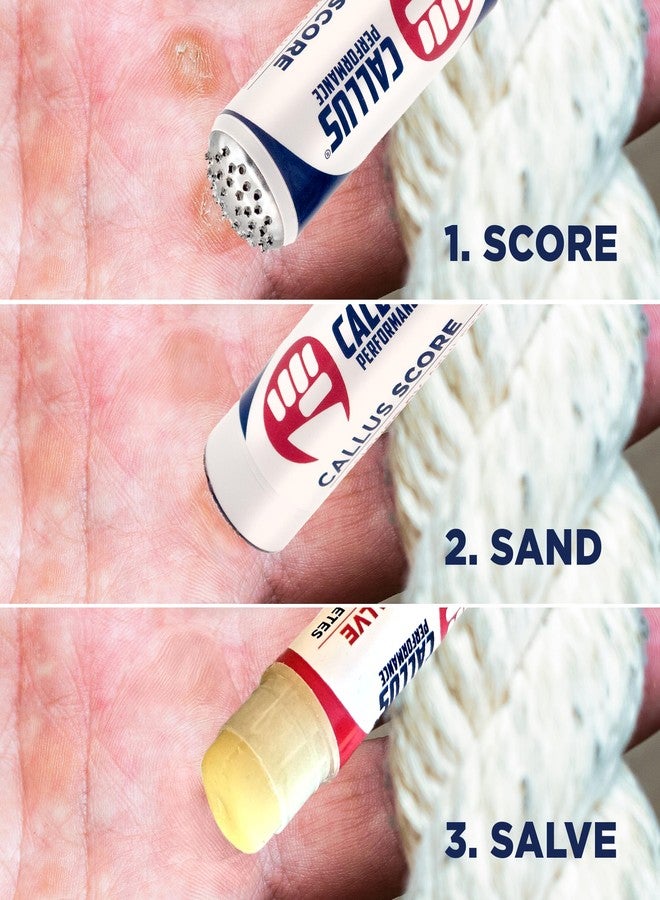 Callus Performance Callus Score, Healing Salve & 2 Smoothers - Ultimate Precision Hand Callus Remover | Prevents Ripping | Smoother for Athletes, Weightlifters & Gym Enthusiasts | Solution for Dry, Rough Hands & Fingers - Image 5