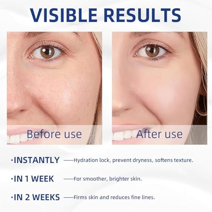 IREV كريم الريتينول وفيتامين سي، مرطب للوجه، مرطب للوجه 2 في 1 نهاراً وليلاً، مرطبات يومية، مرطب وجه مرطب للبشرة الجافة، مرطب خفيف الوزن 3.53 أونصة - Image 3