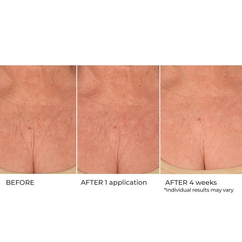 nassif md Age Defying Neck Decollete Treatment Serum Neck Tightening Serum for Neck Firming Neck Wrinkle Serum for saggy neck Neck Firming Sagging Skin - Image 3