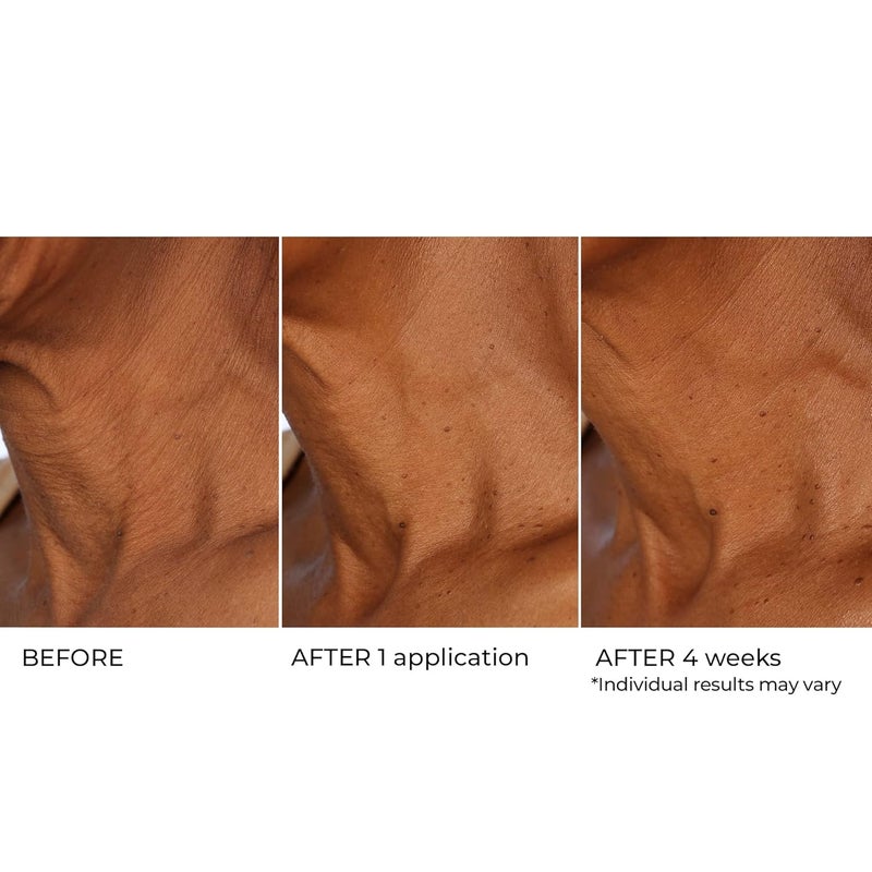 nassif md Age Defying Neck Decollete Treatment Serum Neck Tightening Serum for Neck Firming Neck Wrinkle Serum for saggy neck Neck Firming Sagging Skin - Image 5