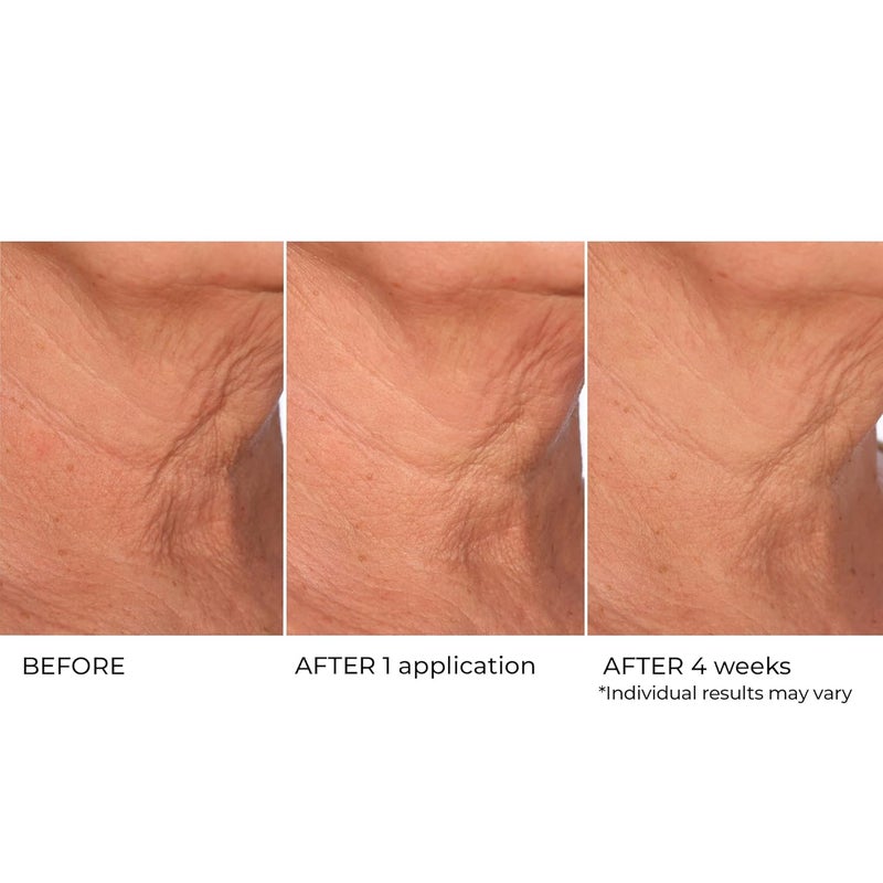 nassif md Age Defying Neck Decollete Treatment Serum Neck Tightening Serum for Neck Firming Neck Wrinkle Serum for saggy neck Neck Firming Sagging Skin - Image 4