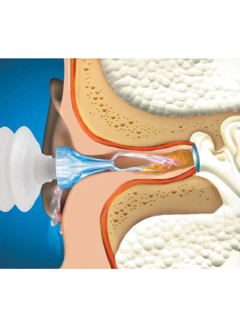 Mack's Prorinse Earwax Removal Syringe  - Image 3