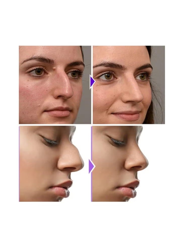 Nose Shaper Clip Nose Bridge StraightenerCorrector Soft Silicone Slimmer RhinoplastyDevice Nose Up Lifting Clip Nose Shaper forWomen，Takes On Loose Cartilage and Skin On The Nose's Tip, Giving You a Firmer and More Youthful Appearance, Comfortable and User-Friendly - Image 4