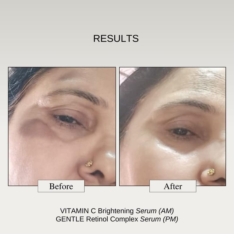 The Formularx 10 Vitamin C Face Serum with 2 Arbutin for Glowing Skin Advanced Skin Brightening Serum for Dark Spots Pigmentation Acne Marks Beginner Sensitive Skin Friendly For Men and Women All Skin Types 30g - Image 4