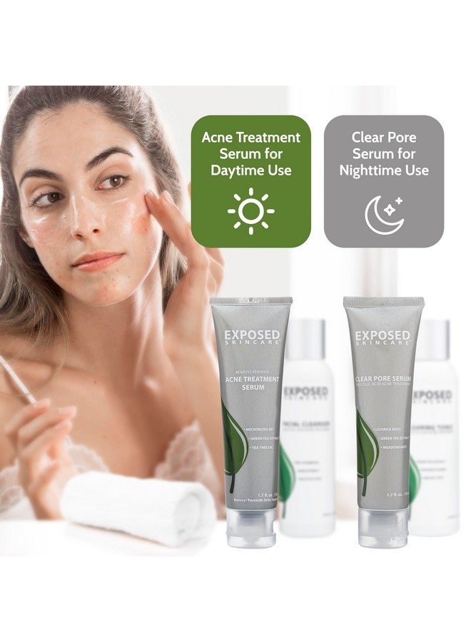 Exposed Skin Care Exposed Skin Care Basic Acne Treatment Kit - Includes Salicylic Acid Face Wash, Clearing Tonic, Acne Treatment Serum with Benzoyl Peroxide, Clear Pore Serum - Acne Set Solution for All Skin Types - Image 5
