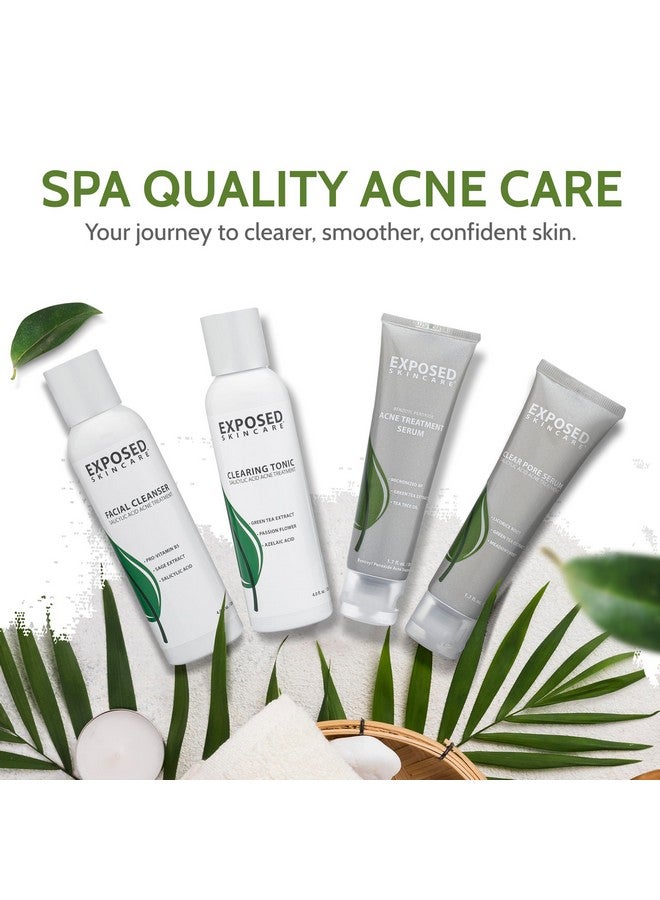 Exposed Skin Care Exposed Skin Care Basic Acne Treatment Kit - Includes Salicylic Acid Face Wash, Clearing Tonic, Acne Treatment Serum with Benzoyl Peroxide, Clear Pore Serum - Acne Set Solution for All Skin Types - Image 3