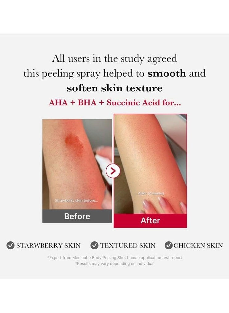 Medicube Red Body Peeling Shot – Exfoliating Spray Cleanser for Strawberry Skin with AHA, BHA & Succinic Acid (3.88 oz)  - Image 2