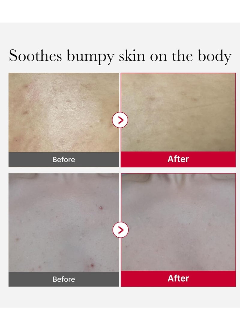 Medicube Red Body Peeling Shot – Exfoliating Spray Cleanser for Strawberry Skin with AHA, BHA & Succinic Acid (3.88 oz)  - Image 3
